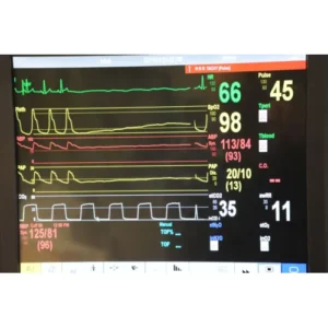 Advanced ICU Multiparameter Patient Monitor for ICU Patient Monitoring